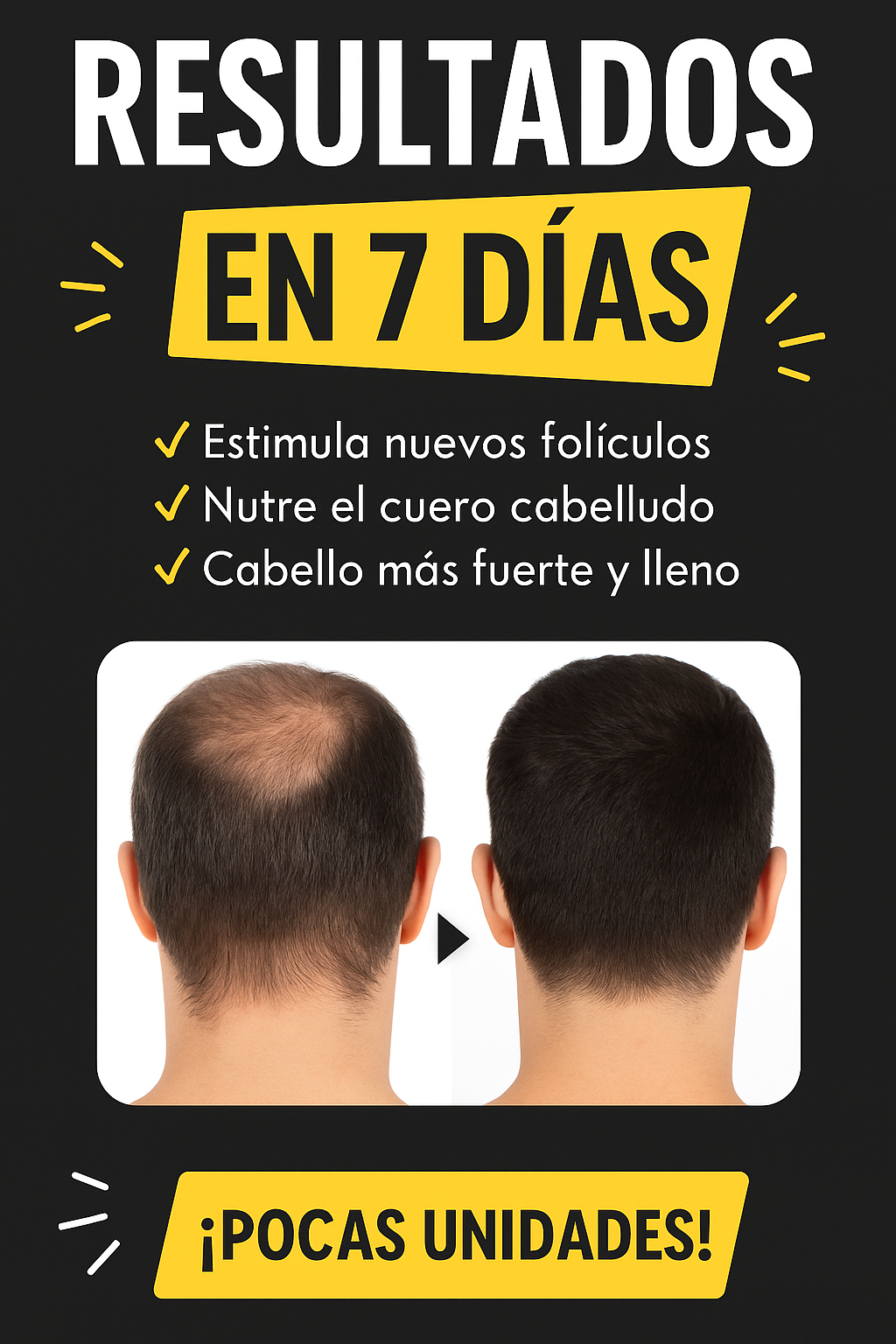 Crecimiento Capilar Spray Llevalo por solo $69.000